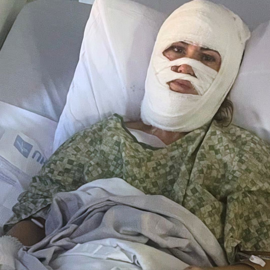 Acid Attack in Forsyth Park: A Community’s Sense of Safety Shattered